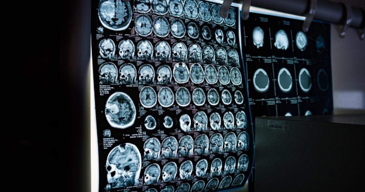 What is Medical Imaging