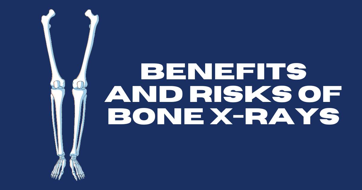 Benefits and Risks of Bone X-rays