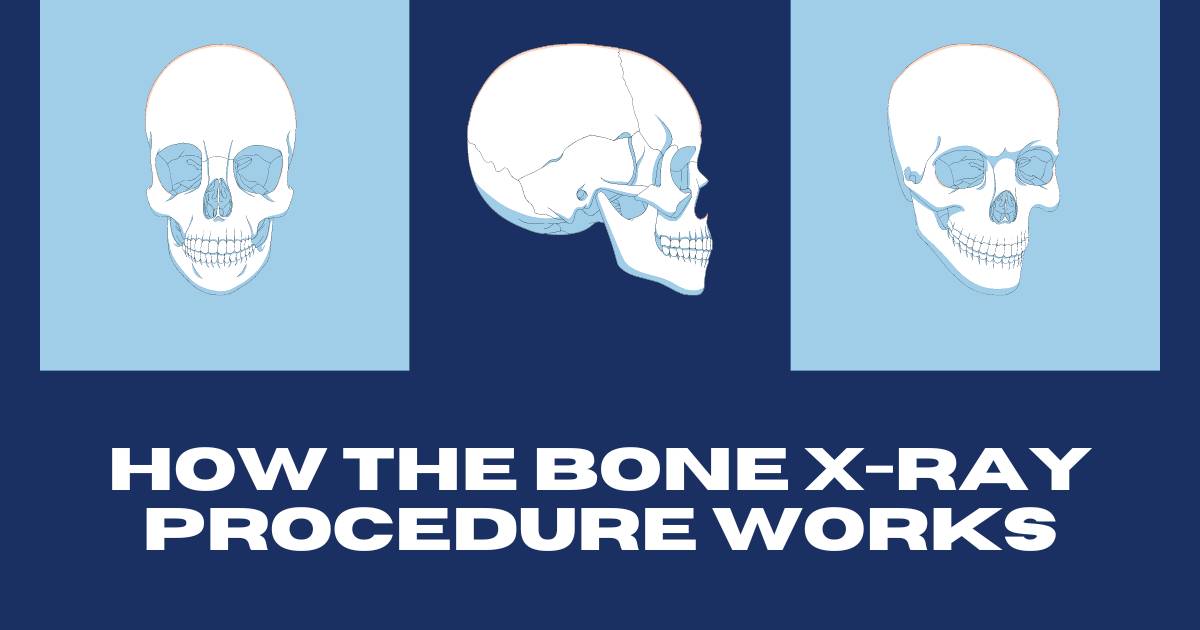 How the Bone X-ray Procedure Works