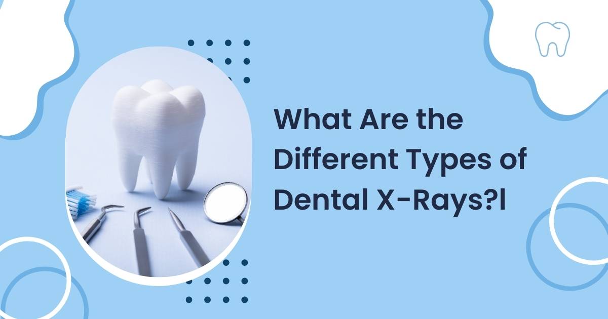 What Are the Different Types of Dental X-Rays