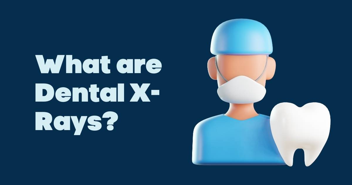 What are Dental X-Rays