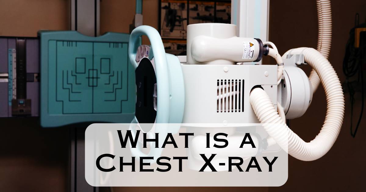 What is a Chest X-ray