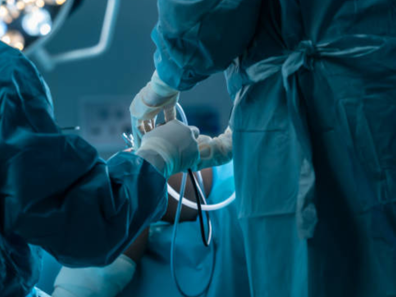 laparotomy-vs.-laparoscopy