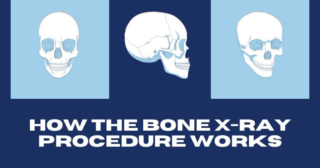 Bone X-rays: How They Work, Procedure, and What to Expect