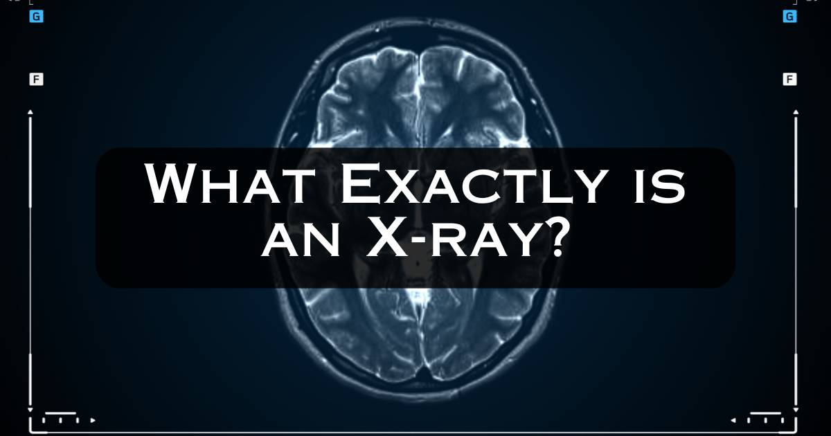 What Exactly is an X-ray