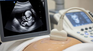 ultrasound therapy machine